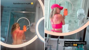 «El sol de Australia no es broma»: la foto de una tenista mexicana que muestra el riesgo en el país con las tasas de cáncer de piel más altas del mundo